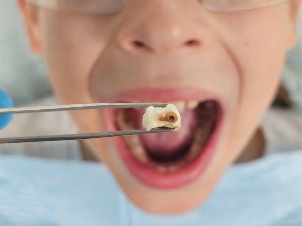Best Pediatric Emergency Dentist in Morristown, NJ